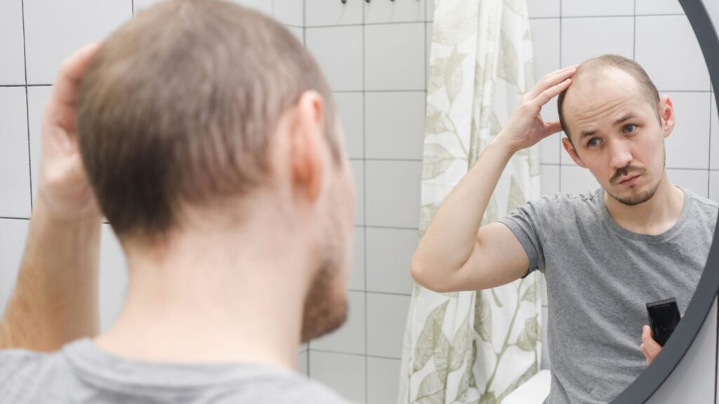 Can Adderall Cause Hair Loss
